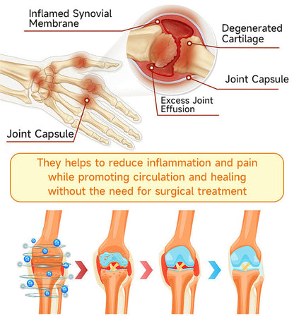 Odeiun™ Magnesium Oil & Bee Venom Joint Healing Spray