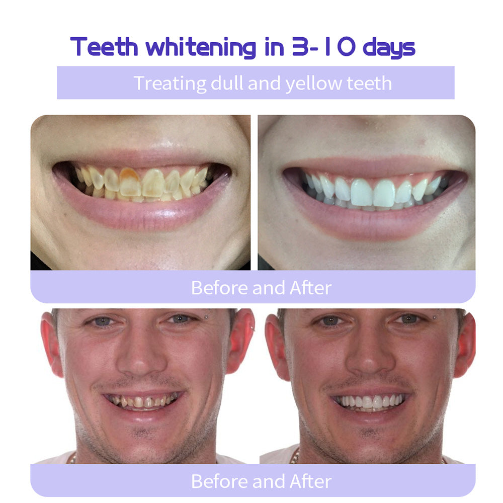 Seurico™ Teeth Restoration Mineral Powder