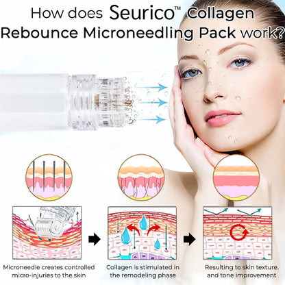 Turn Back the Clock with Seurico™ Collagen Rebounce Microneedling Pack – For Ageless, Radiant Skin! ✨