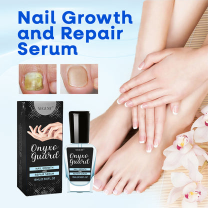 ✨Negusy™ OnyxoGuard: The Ultimate Nail Growth & Repair Serum for Stronger, Healthier Nails💅