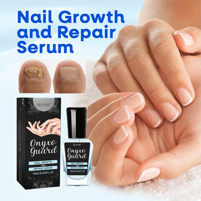 ✨Negusy™ OnyxoGuard: The Ultimate Nail Growth & Repair Serum for Stronger, Healthier Nails💅